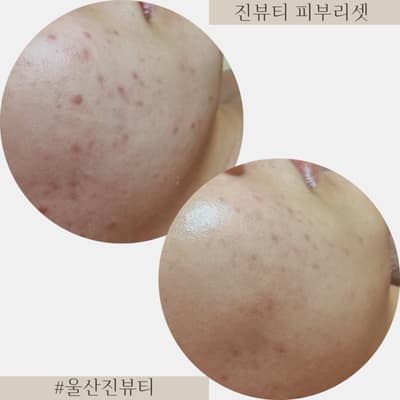[울산] 진뷰티