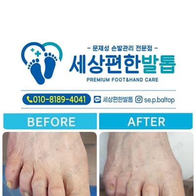 [전남 광양] 세상편한발톱