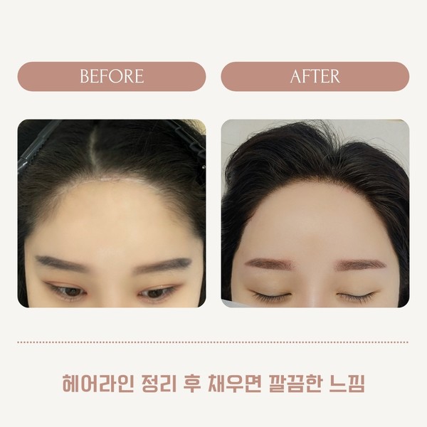 [서울 서대문구] 인뷰티